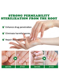 7days Nail Fungus Treatment for Nail Care Onychomycosis Repair and Moisturizing, Nail Nutrient Oil Strengthener Oil Serum Ginger Nail Growth Oil 30ml - pzsku/ZE89B56625C233CBF8EC5Z/45/_/1730191712/53f9b79d-2c51-40f3-b102-b5c7bc556d85