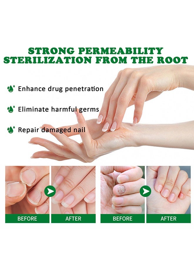 7days Nail Fungus Treatment for Nail Care Onychomycosis Repair and Moisturizing, Nail Nutrient Oil Strengthener Oil Serum Ginger Nail Growth Oil 30ml