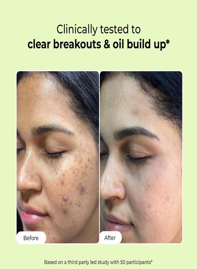Conscious Chemist Daily Face Wash For Oily Acne Prone Skin with Salicylic Acid, Glycolic Acid & CICA Extract | For Acne & Radiant Skin | Cruelty Free | Pack of 2 - Image 2