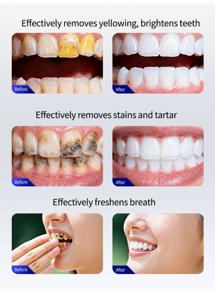 LYDIMOON Hydroxyapatite Whitening Toothpaste Stain Removal Fresh Breath Enamel Repair 100g - Image 5