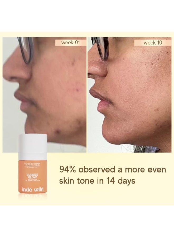 indē wild Sunrise Glow 15% Vitamin C Serum (30 ml) | With Turmeric, Niacinamide, Ashwagandha, and Hyaluronic Acid | Suited for Acne Scars, Hyperpigmentation, Brightening, Anti-Aging and Dry Skin - Image 3