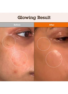 Blithe Korean Niacinamide Serum Dark Spot Corrector Face Brightening Serum Vitamin B3 Niacinamide Serum For Face Skin Soothing Cica & Allantoin Arbutin & Tranexamic Acid 1Oz  - Image 3