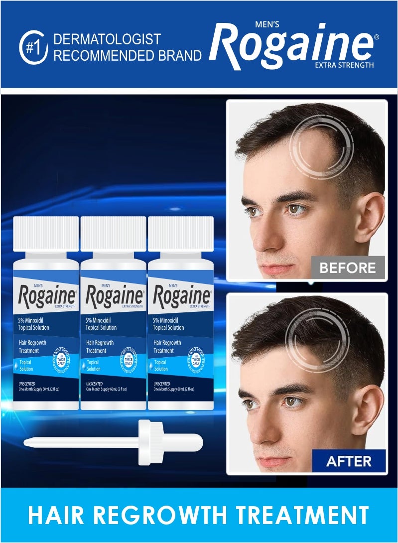 Regaine Extra Strength Rogaine for Men 3x60ml – Hair Loss and Regrowth Formula - Image 2