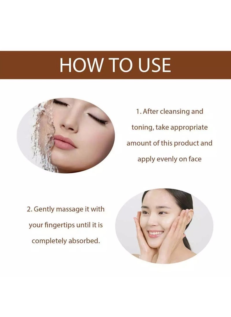 Hoygi - Niacinamid Dark Spot Remove Serum Anti-Aging Bright Freckle Whiten Skin Care - Image 1