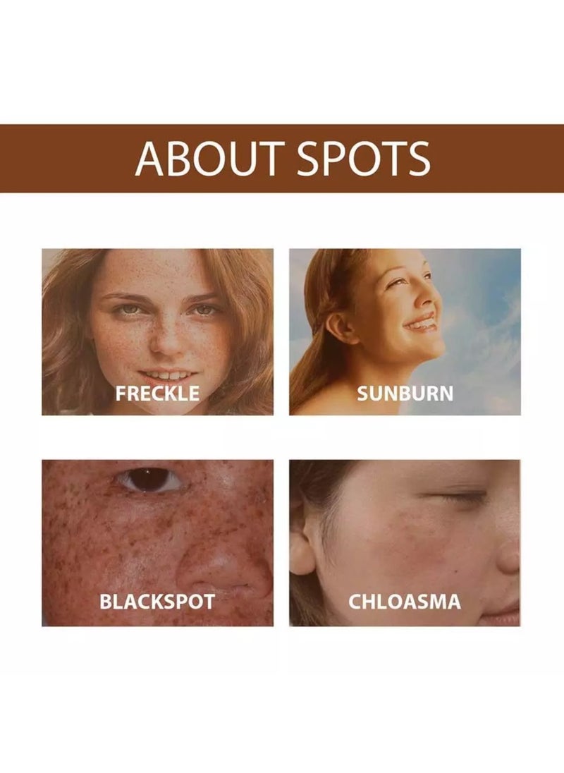 Hoygi - Niacinamid Dark Spot Remove Serum Anti-Aging Bright Freckle Whiten Skin Care - Image 1