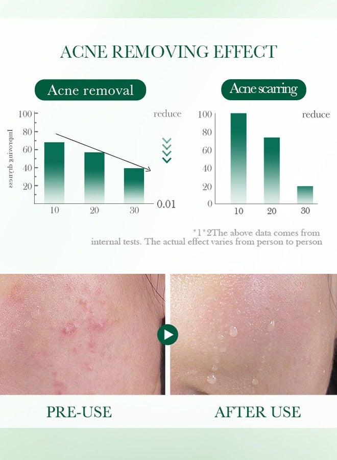 SADOER Salicylic Acid Anti Acne Serum，Contains Salicylic Acid, Niacinamide, Centella Asiatica Extract, And Ceramide To Clear Acne, Fade Acne Marks, Acne Treatment And Repair Damaged Skin (40ml) - Image 4