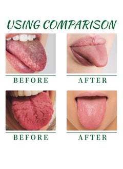 EELHOE Mouth Repair Spray Repairs White Tongue Coating, Relieves Dry and Swollen Tongue, Tongue Care Spray, Portable Mouth Spray, Mouthwash Spray, Gargle, Freshens Breath, Eliminates Bad Breath  - Image 3