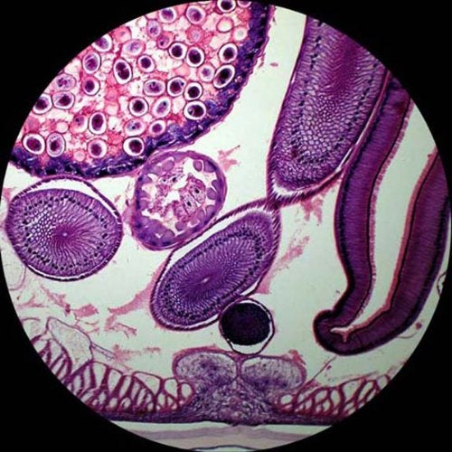 AmScope AmScope PS50A Prepared Microscope Slide Set for Basic Biological Science Education 50 Biology and Pathology Slides Includes Fitted Wooden Case  - Image 5