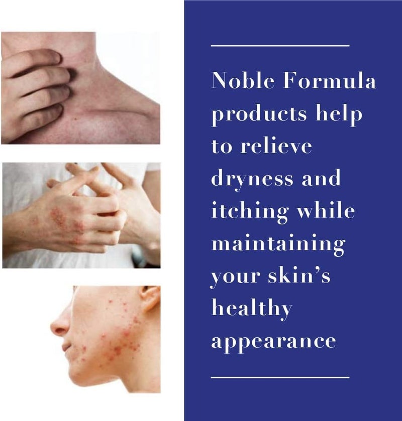 Noble Formula Zinc Spray 25 Pyrithione Zinc ZnP 4 oz - Image 4
