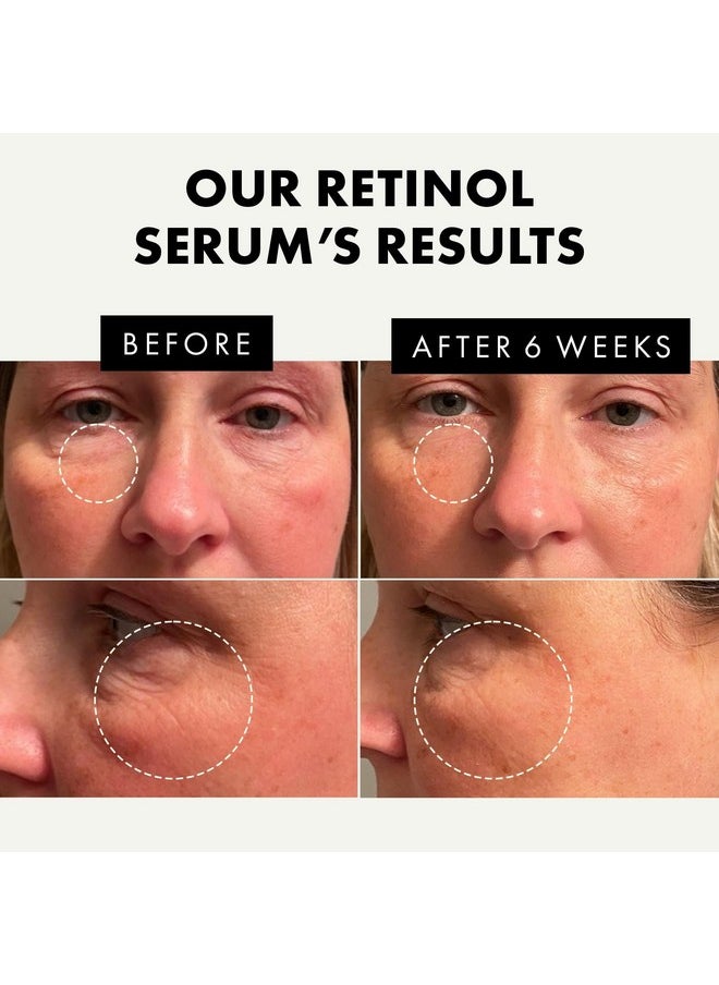 Eclat Skincare Retinol Serum For Face 2.5% Resurfacing Retinol Serum Acne Scar Treatment Serum Retinol Face Serum Ordinary Serum Retin A Anti Wrinkle Serum Retnol Facial Acne Retinol Serum  - Image 3