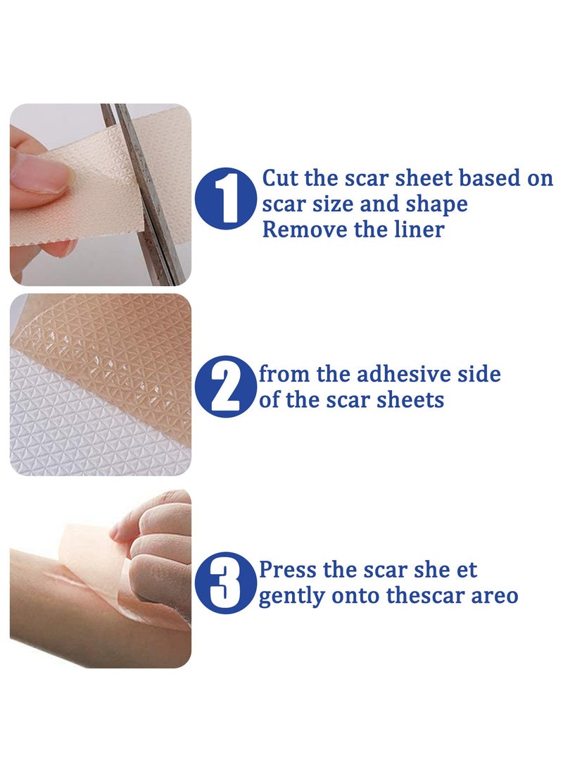 SOUTH MOON - 4 PCS Professional Silicone Scar Sheets, Scar Removal Patch for Scars Stretch Mark Treatment Waterproof, Effective Safe Breathable Comfortable Long-Lasting Results Scar Care - Image 1