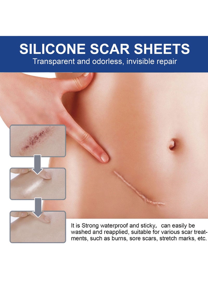 SOUTH MOON - 4 PCS Professional Silicone Scar Sheets, Scar Removal Patch for Scars Stretch Mark Treatment Waterproof, Effective Safe Breathable Comfortable Long-Lasting Results Scar Care - Image 1