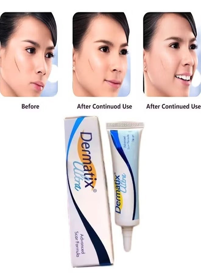 Dermatix 2-Pack Advanced Scar Gel for Cosmetic Improvement of Scars, Fast Drying and Unique Silicone Gel Formulation - Image 2