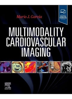 Multimodality Cardiovascular Imaging 