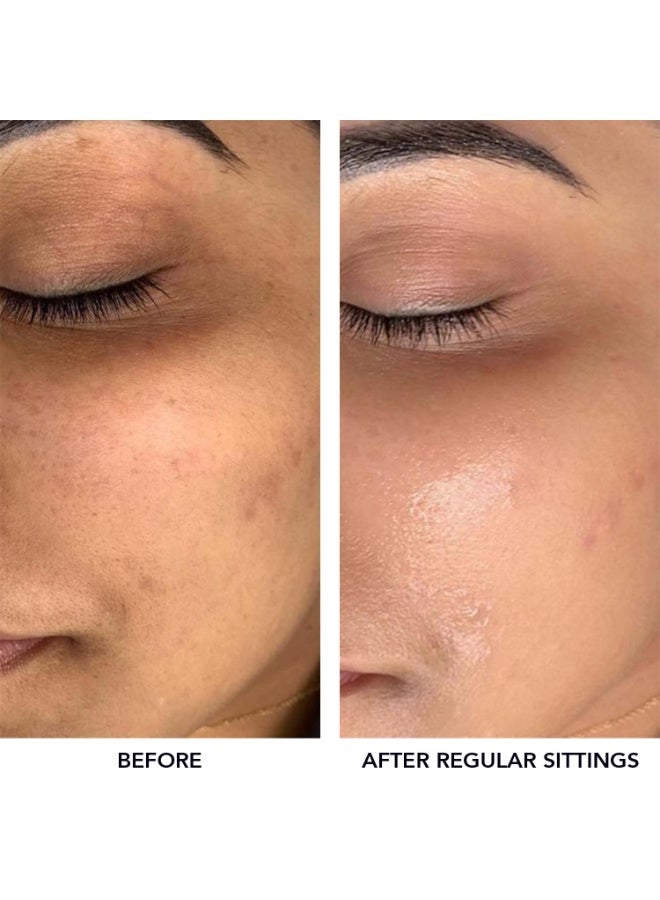 O3+ Meladerm Vitamin C Gel Bleach 96g for Skin Brightening Dull Skin | TAN Removal for Face, Suitable for Men & Women - Image 4