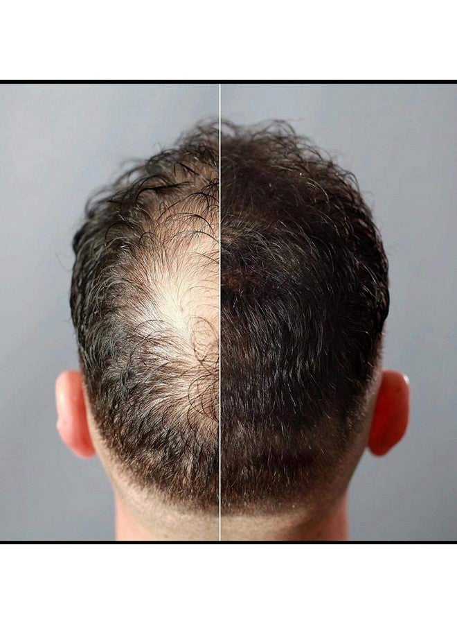 جوفينايل ألياف بناء الشعر بني غامق 15 جرام للشعر الفوري - Image 4