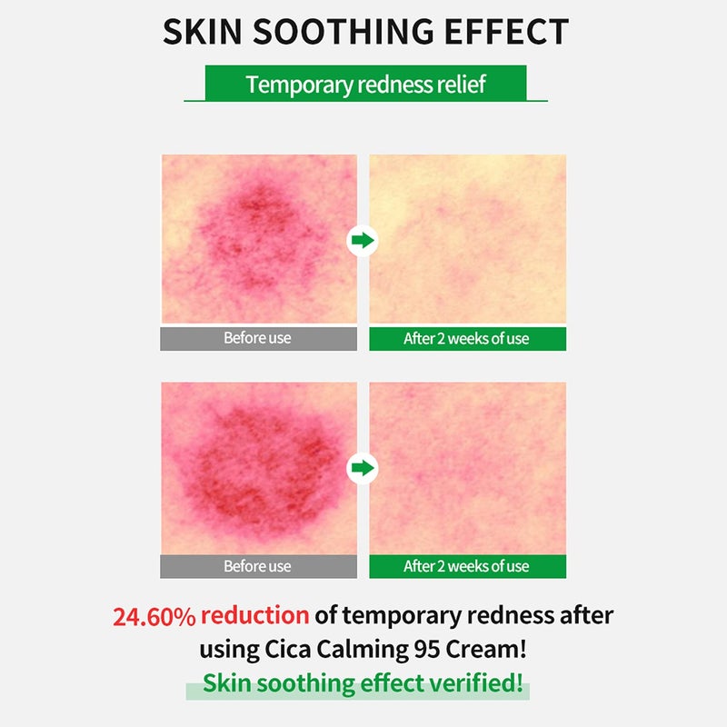 WELLAGE Cica Calming Cream - Korean Face Soothing Moisturizer, High Purity Madecassoside with Centella Asiatica Panthenol - Calms Sensitive Skin, Anti-Redness & Rosacea, Anti-Scaling & Blemish, 2.7oz - Image 5