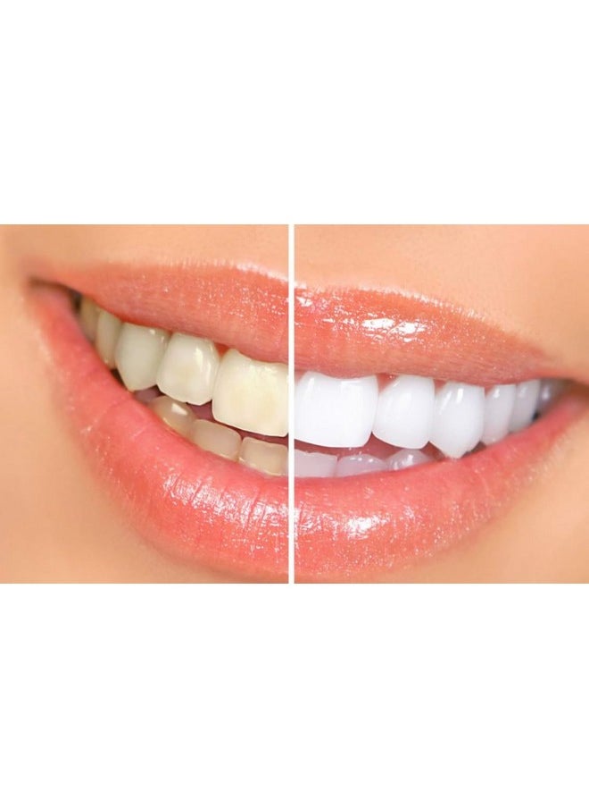 Pepsodent Complete Care Toothpaste Original Flavor 5.5 Oz (Pack Of 24)  - Image 5