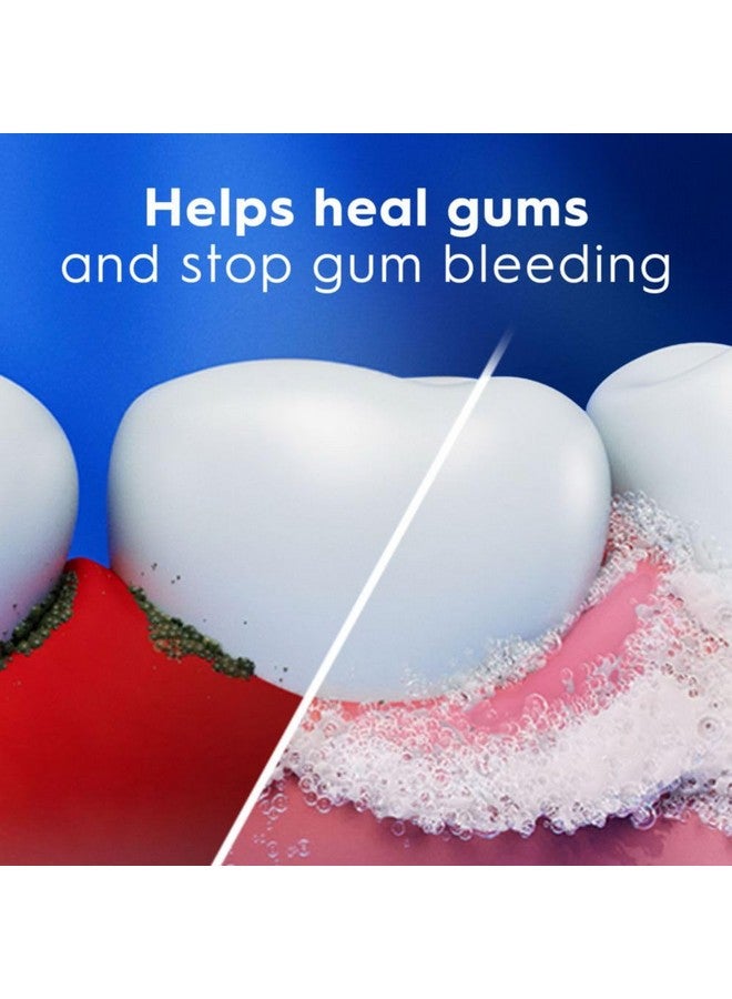 كرست معجون أسنان كريست برو هيلث لإزالة سموم اللثة وتنظيف عميق، عبوة من 3 قطع، 4.8 أونصة - معجون أسنان مضاد للتسوس، مضاد للبكتيريا، مُثبت سريريًا، يحمي اللثة والمينا، ويتحكم في البلاك - Image 4