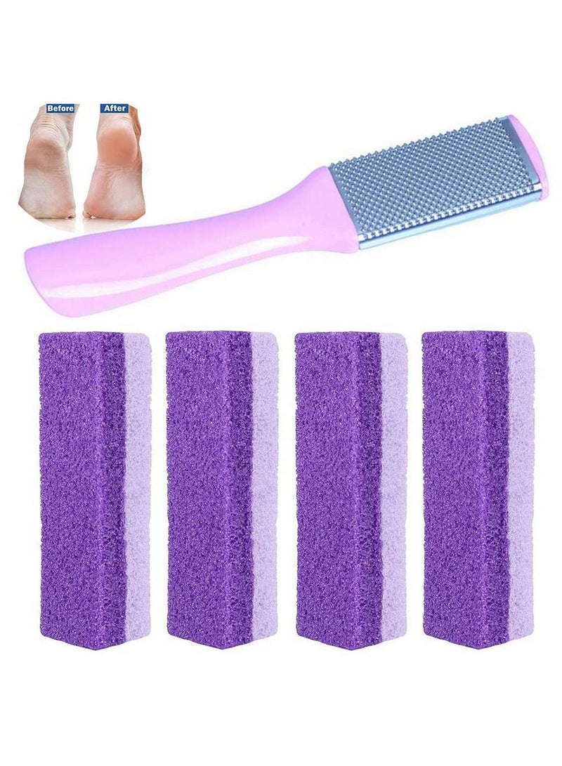 Y&D Pu Foot Grinding Stone Pumice Exfoliating Callus Dead Hard Skin Remover File Scrubber Pedicure Care Tool Foam Beauty New Pattern Two-color Stone, 5 Pcs  - Image 1