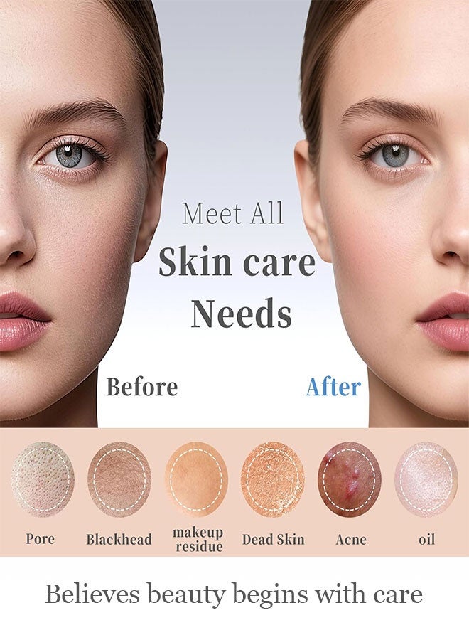 HieerBus Blackhead Remover Tools, Black Head Remover for Face and Nose, Skin Scrubber Face Spatula Deep Pore Cleaner for Daily Skin Care, Skin Care Tools for Men and Women, Whitehead Removal (Green) - Image 3