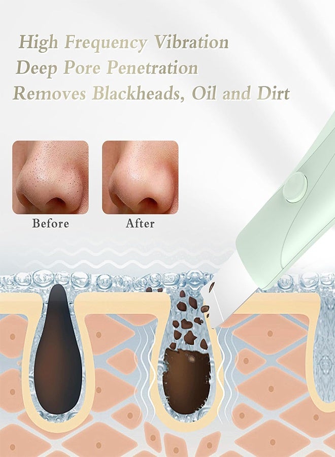 HieerBus Blackhead Remover Tools, Black Head Remover for Face and Nose, Skin Scrubber Face Spatula Deep Pore Cleaner for Daily Skin Care, Skin Care Tools for Men and Women, Whitehead Removal (Green) - Image 5