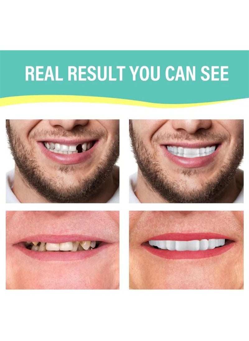 Y-Kelin - Teeth Grinding, Comfortable Bite Splint, Grinding Splint for Night, Bite Splint, Teeth Grinding, Set of 2-Individual Adjustment, Stops Bruxism and Eliminates Teeth Grinding - Image 1