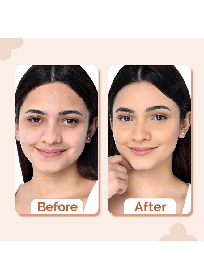 THE derma Co - 2% Niacinamide Medium Coverage Matte Liquid Foundation For All Skin Types With 1% Hyaluronic Acid & Spf 40 Pa+++ For 12 Hour Long Stay & Oil Control - 01 Ivory, Pack Of 1 - Image 1