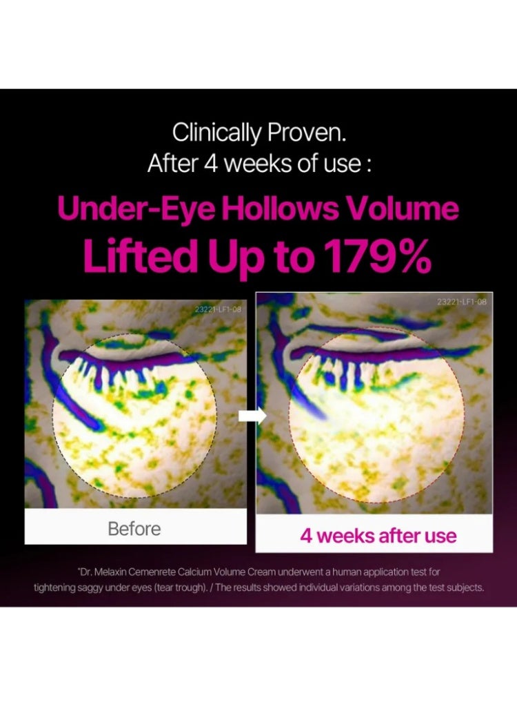 دكتور ميلاكسين Dr. Melaxin Cemenrete Calcium Volume لشد البشرة وترطيبها وتعزيز مرونتها - Image 3