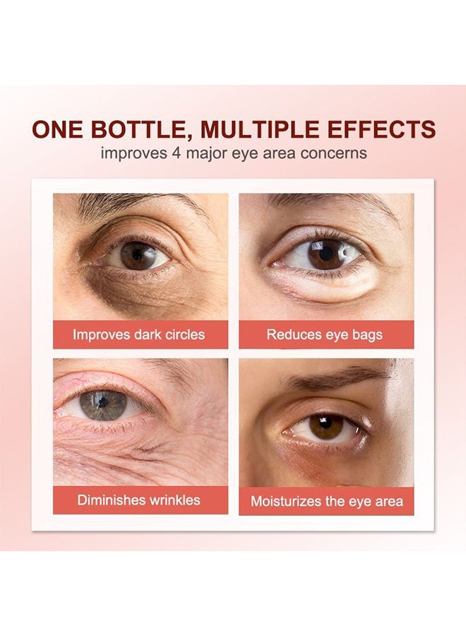 AuQuest Anti Dark Circles And Eye Bags Cream 20G, Fade Dark Circles, Remove Fine Lines And Eye Bags, Anti-Wrinkle Anti-Aging Firming Brighten Skin Cream, Eye Care Cream - Image 5