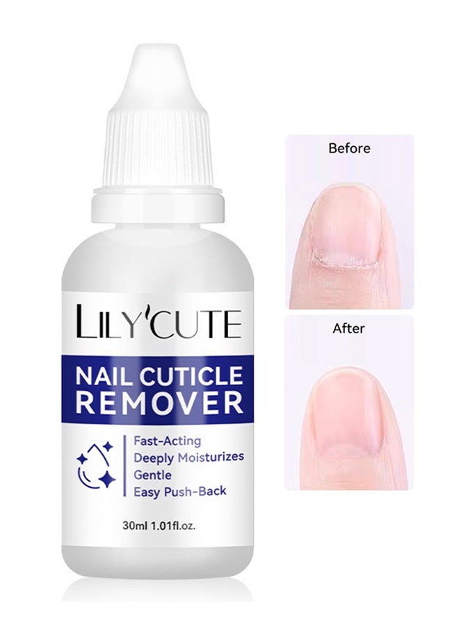ليلي كيوت مزيل الجلد الزائد للأظافر، قارِض الجلد الزائد - مزيل جلدي فوري للأظافر، مرطب لحواف الأظافر، يزيل الجلد الزائد في ثوانٍ، عناية بالأظافر 30مل - Image 1