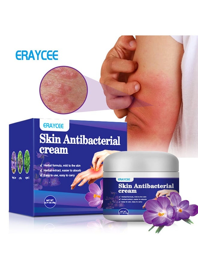 ERAYCEE Skin Antibacterial Cream,Itchy Skin Cream, Mosquito Bite Anti-Itch Cream, Anti-Itch Artifact 20g - Image 1