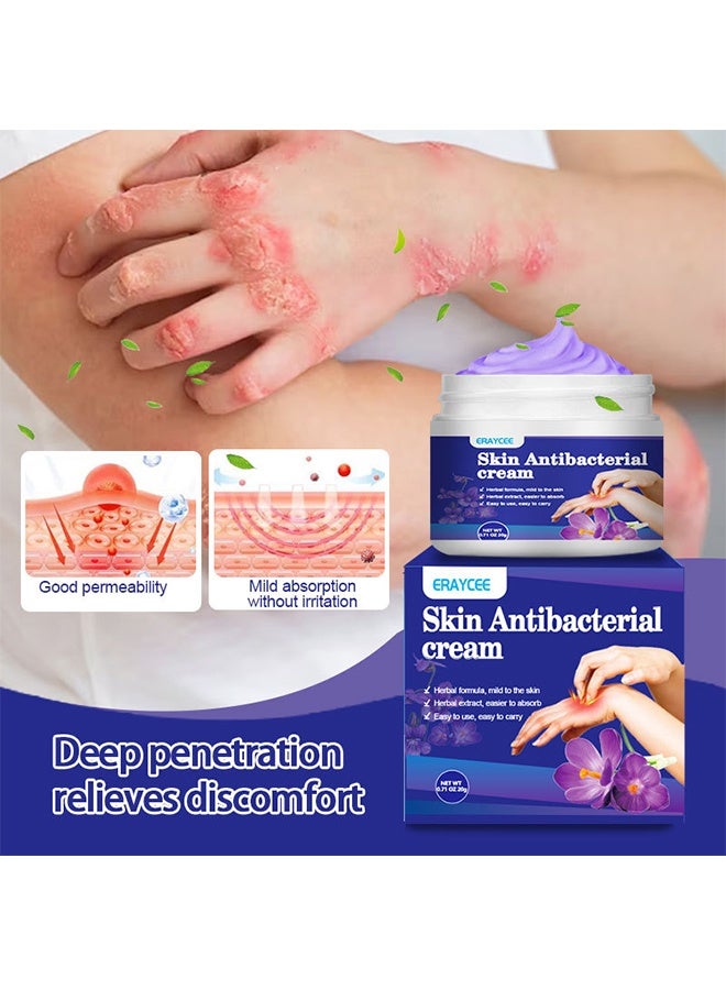 ERAYCEE Skin Antibacterial Cream,Itchy Skin Cream, Mosquito Bite Anti-Itch Cream, Anti-Itch Artifact 20g - Image 2