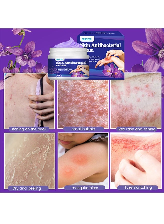 ERAYCEE Skin Antibacterial Cream,Itchy Skin Cream, Mosquito Bite Anti-Itch Cream, Anti-Itch Artifact 20g - Image 5