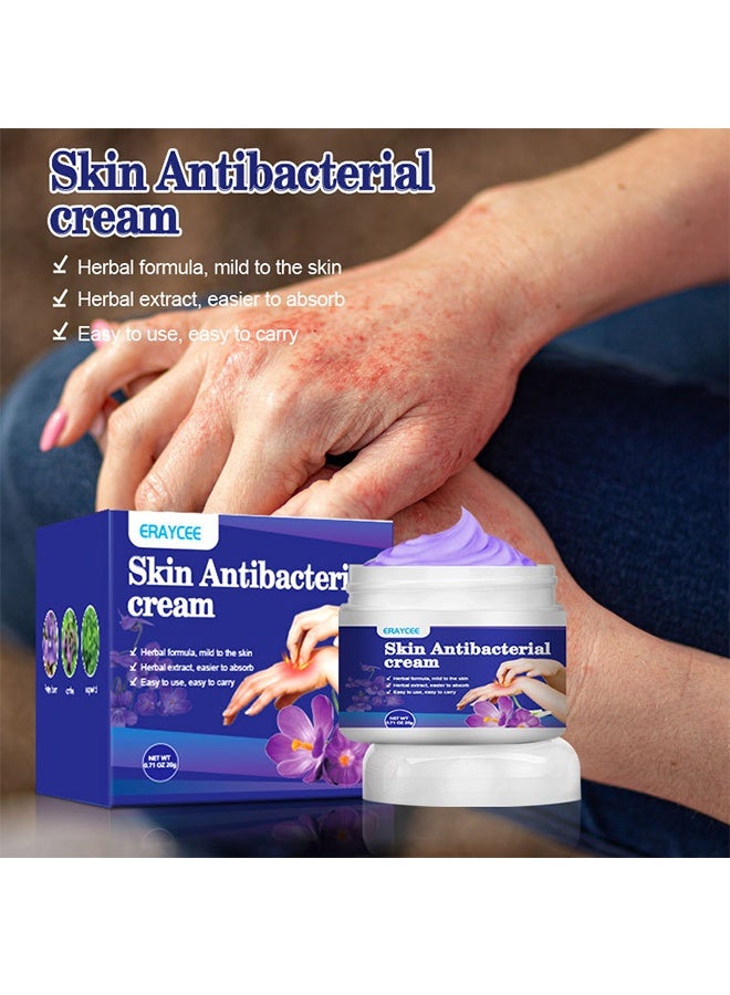 ERAYCEE Skin Antibacterial Cream,Itchy Skin Cream, Mosquito Bite Anti-Itch Cream, Anti-Itch Artifact 20g - Image 3