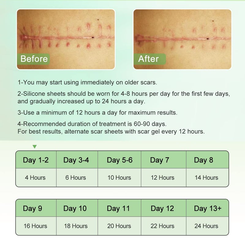 ZODENIS Silicone Scar Sheets 16 Pcs Scar Tape Strips Healing Surgery Scar Keloid CSection Reusable Scars Treatment Professional Scar Remover Sheets Cream Gel Patch Bandage Pads - Image 4