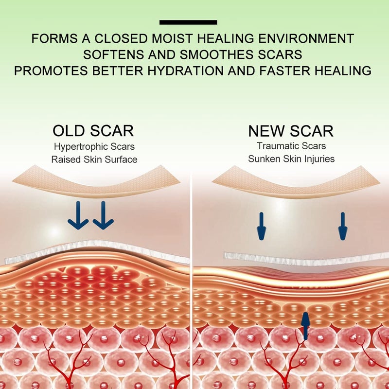 ZODENIS Silicone Scar Sheets 16 Pcs Scar Tape Strips Healing Surgery Scar Keloid CSection Reusable Scars Treatment Professional Scar Remover Sheets Cream Gel Patch Bandage Pads - Image 3