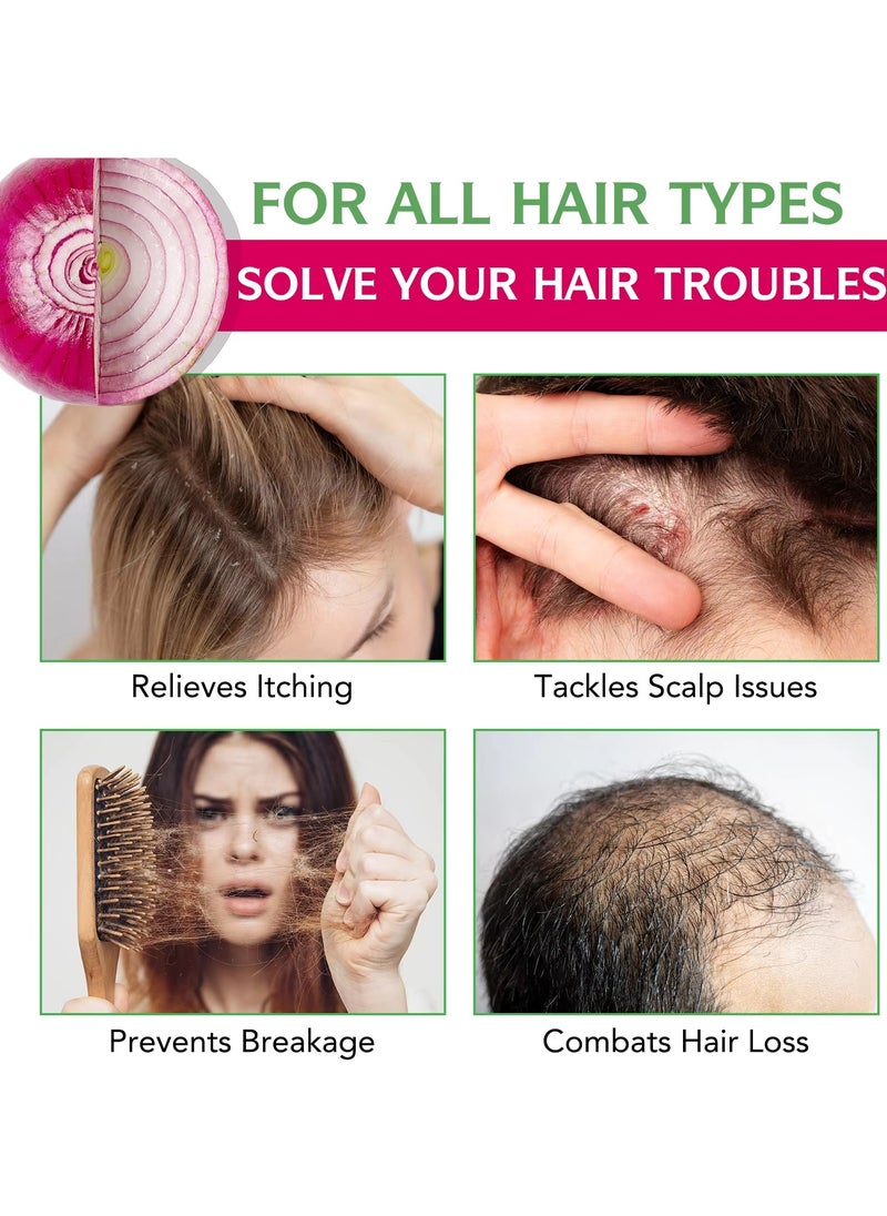 IKZEE 250ml Onion Rosemary Hair Shampoo with Biotin for Hair Growth Repairs Dry Damaged Hair Activates Hair Follicles Scalp Treatment Onion and Rosemary Hair Shampoo for Hair Regrowth  - Image 5