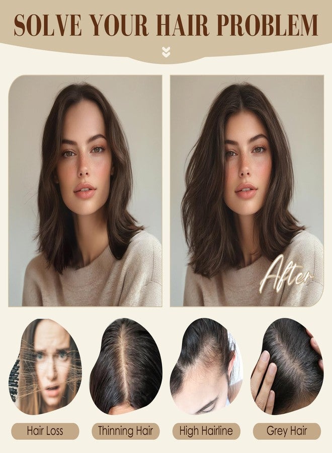 S-noilite Hair Toppers for Women no Bangs Human Hair 360°3D Cover Clip in Short Topper Hairpieces for Women Dark Brown - Image 4