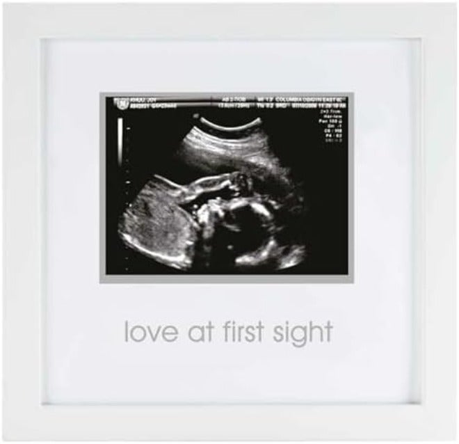 Pearhead Love at First Sight Sonogram Picture Frame, Pregnancy Ultrasound Keepsake Photo Frame, Gender-Neutral Baby Nursery Décor, 4x3 Photo,  White - Image 3