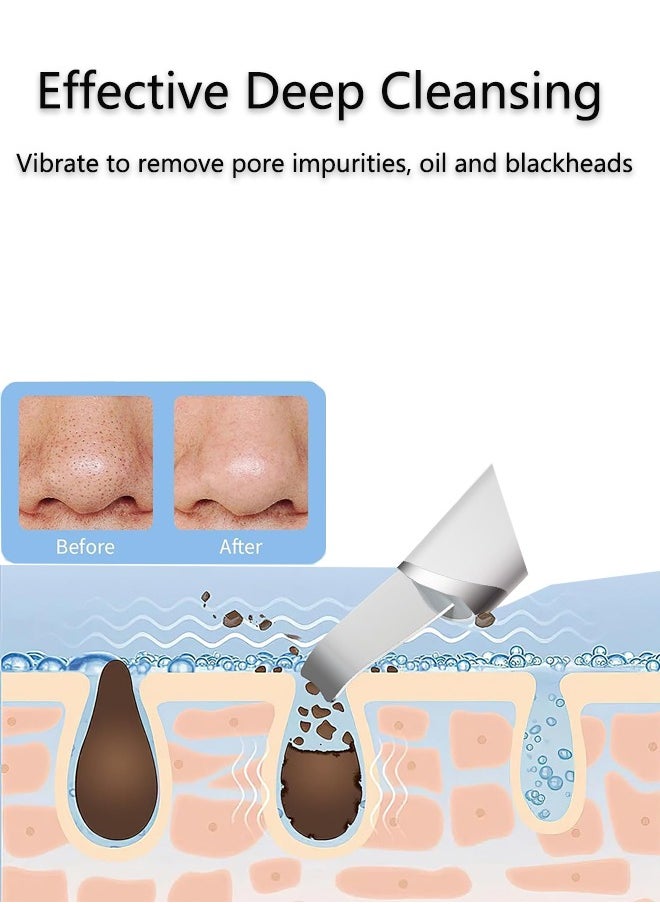 Skin Scrubber,Ultrasonic EMS Ion Exfoliating Device Face Cleanser and Blackhead Remover Pores Cleaning Wrinkle Remover Comedone Extractor Skin Care - https://f.nooncdn.com/p/pzsku/ZE96693CB8CB3F185A612Z/45/_/1714032461/c6f0e990-3736-4cc7-b2f9-871fdab13826.jpg?format=jpg&width=original