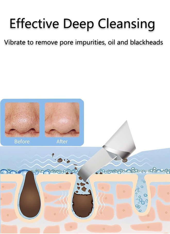 K.SKIN - Skin Scrubber,Ultrasonic EMS Ion Exfoliating Device Face Cleanser and Blackhead Remover Pores Cleaning Wrinkle Remover Comedone Extractor Skin Care - Image 1