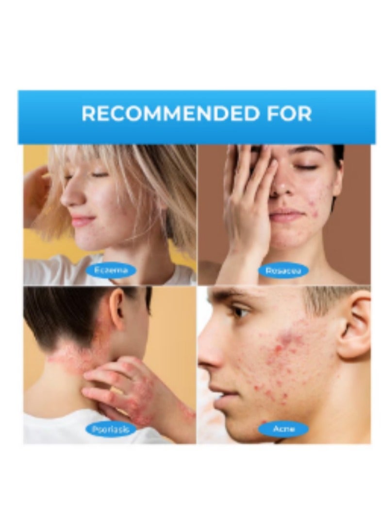 Sumifun Extra Strength Calamine Psoriasis Ointment, Promote Skin Health Relieve Psoriasis, Eczema and Urticaria Relieve Skin Itching & Inflammation 20g - Image 2