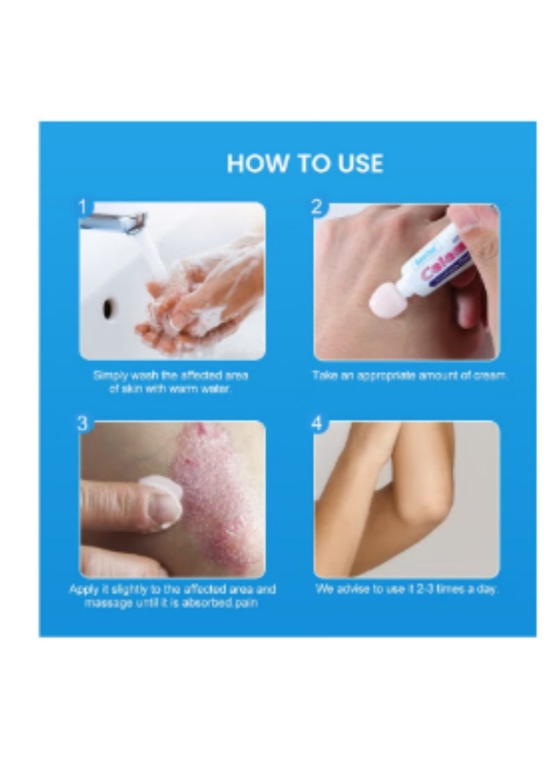 Sumifun Extra Strength Calamine Psoriasis Ointment, Promote Skin Health Relieve Psoriasis, Eczema and Urticaria Relieve Skin Itching & Inflammation 20g - Image 3