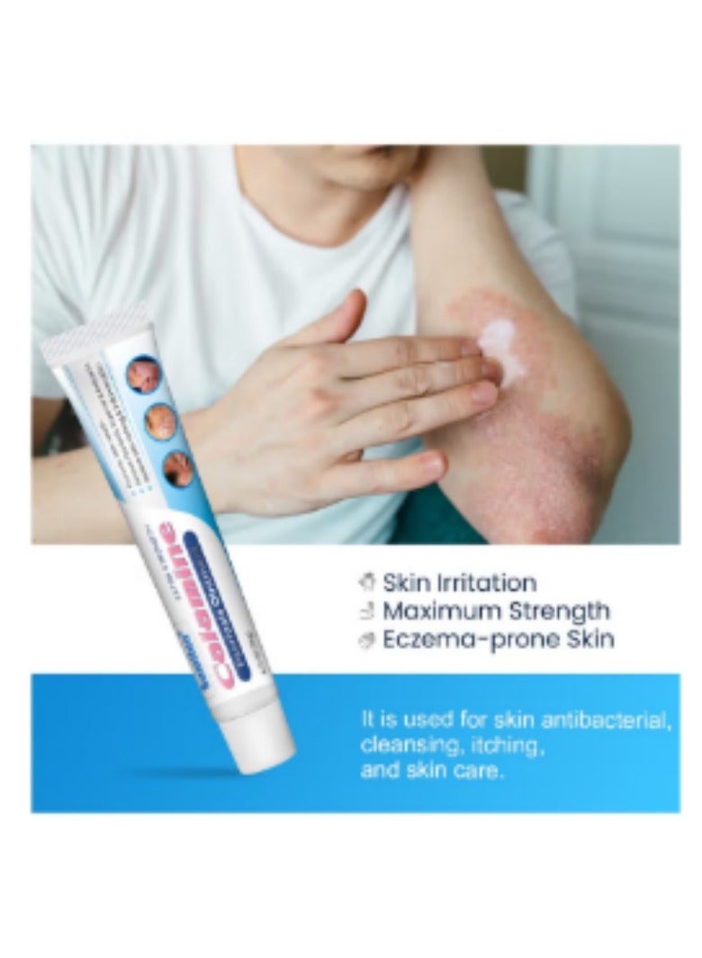 Sumifun Extra Strength Calamine Psoriasis Ointment, Promote Skin Health Relieve Psoriasis, Eczema and Urticaria Relieve Skin Itching & Inflammation 20g - Image 5