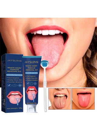 White Hairy Tongue Removal Kit, Tongue Cleaning Gel Set, Tongue Cleaner Gel with Soft Tongue Brush, Easy to Use Tongue Scraper Precise Cleaning Brush Kit, Keep Fresh Breath 50G - view 2