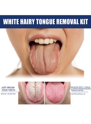 White Hairy Tongue Removal Kit, Tongue Cleaning Gel Set, Tongue Cleaner Gel with Soft Tongue Brush, Easy to Use Tongue Scraper Precise Cleaning Brush Kit, Keep Fresh Breath 50G - view 4
