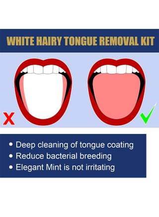White Hairy Tongue Removal Kit, Tongue Cleaning Gel Set, Tongue Cleaner Gel with Soft Tongue Brush, Easy to Use Tongue Scraper Precise Cleaning Brush Kit, Keep Fresh Breath 50G - view 5