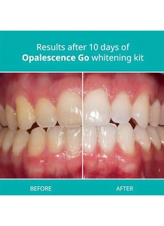 Opalescence Whitening Bundle - Opalescence Go 15% Hydrogen Peroxide Prefilled Whitening Trays and Whitening Toothpaste - Mint Flavor 5194-5166  - Image 3