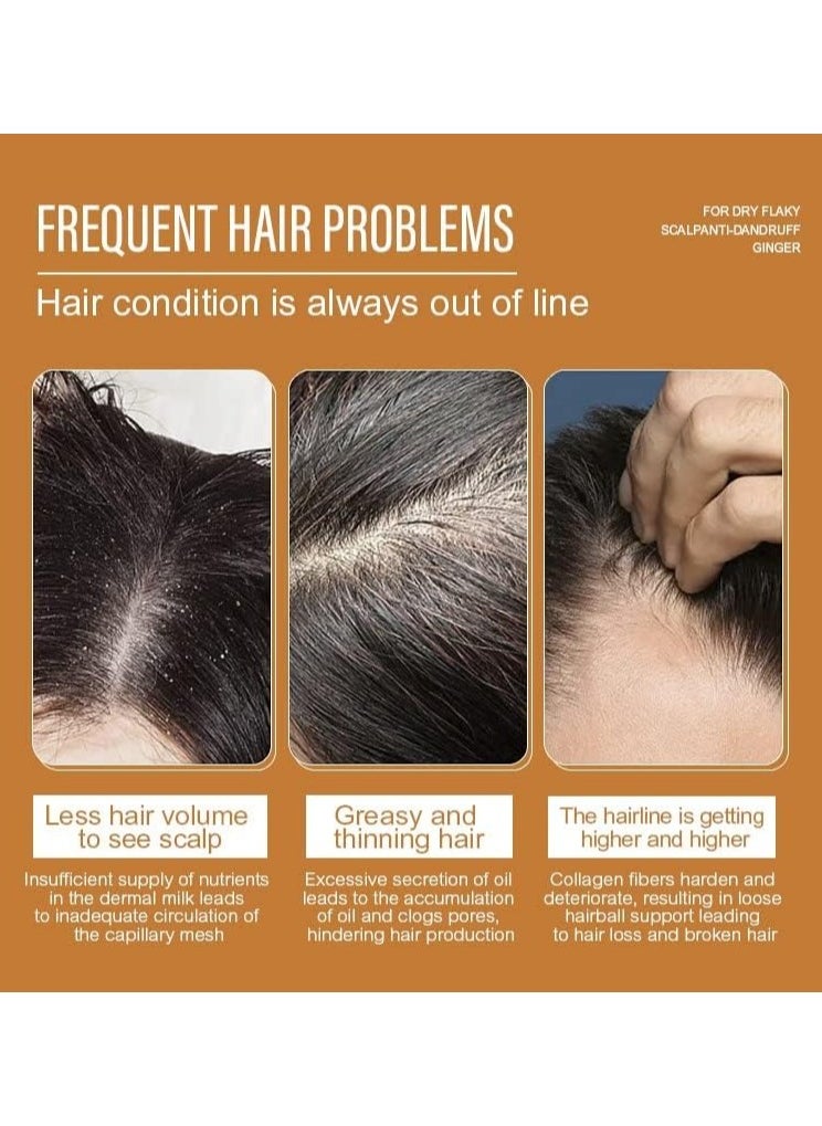 JAN LONDON JAN LONDON Ginger Hair Regrowth, Shampoo For Dry Flaky Scalp, Ginger Hair Care, Anti-dandruff, Shampoo For Man & Woman 300ml  - Image 3